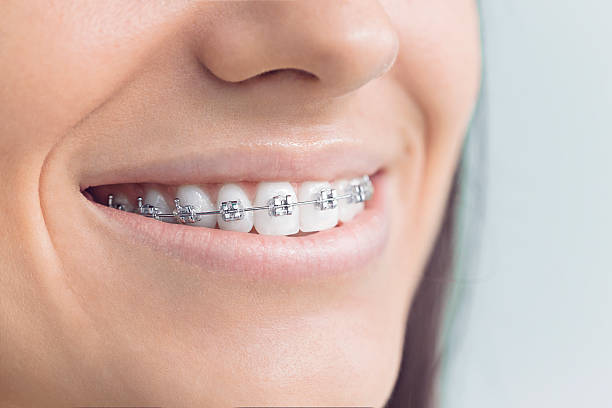 Best Invisalign and Clear Aligners  in Llington, MI